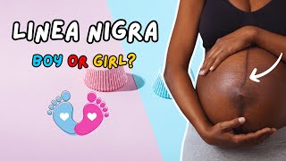 Pregnancy Belly Line  Can the Linea Nigra Predict Your Babys Gender  Boy or Girl Gender [upl. by Notxap781]