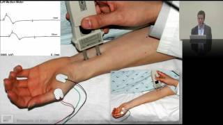 25 Interpreting neurophysiology EMG amp NCS [upl. by Aseretairam242]