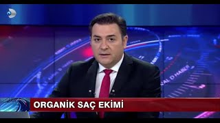 Organik Saç Ekimi Kanal D Haber [upl. by Dorothy700]