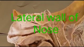 Anatomy of lateral wall of nose nose lateral wall nose [upl. by Enelhtac]