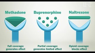 How Opioid Treatment Medications Work On Your Brain  San Diego UnionTribune [upl. by Avigdor32]