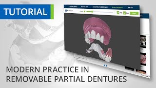 Removable Partial Dentures Tutorial [upl. by Jasun]