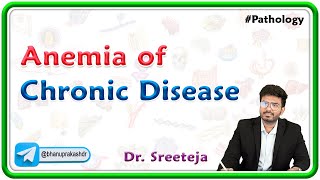 2 Anemia Of Chronic Disease  USMLE Step 1 Pathology [upl. by Ecirehs]