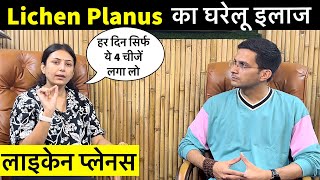 Lichen Planus Treatment Ft upasanakiduniya  Skin Disease  Himanshu Bhatt [upl. by Akissej243]