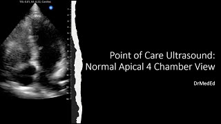 Point of Care Ultrasound POCUS  Normal Apical 4 Chamber View [upl. by Sivehc998]