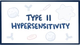 Type II hypersensitivity cytotoxic hypersensitivity  causes symptoms amp pathology [upl. by Dail895]