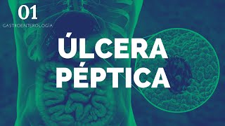 Úlcera péptica  ENARM [upl. by Ailadi]