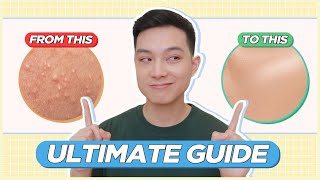 ULTIMATE GUIDE to Treat amp Prevent BLACKHEADS WHITEHEADS TINY BUMPS for FILIPINO SKIN  Jan Angelo [upl. by Henleigh285]