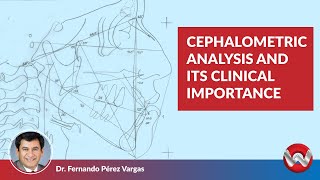 Cephalometric Analysis and its Clinical Importance [upl. by Ysied798]