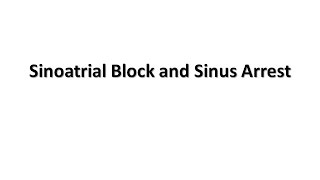 Sinoatrial Block and Sinus Arrest [upl. by Kery]