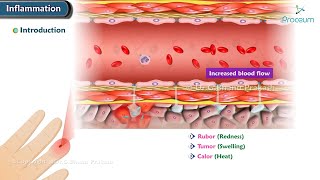 1 Introduction to Acute and Chronic Inflammation Animation [upl. by Hitoshi876]