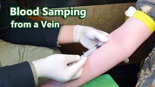 How to Take Venous Blood Sample  Venipuncture  Phlebotomy  Vein [upl. by Perdita743]