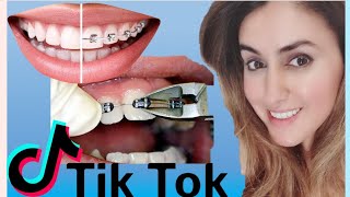 Orthodontist Reacts to Braces Off Tik Toks IV [upl. by Aihsrop]