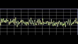 Metabolism Repair  Rife Frequencies [upl. by Nylrem]