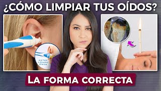 Esta es la forma CORRECTA de limpiar tus oídos 👩🏻‍⚕️l ¿Cotonetes ¿Conoterapia [upl. by Adnilem]