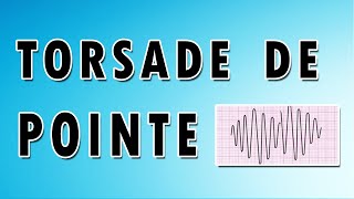 Torsade de Pointes [upl. by Aikemet]