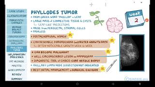 Benign breast conditions  pathology review  Osmosis [upl. by Flora]