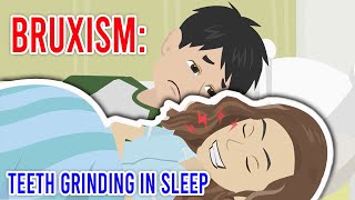 Bruxism Teeth grinding in sleep [upl. by Klemperer]