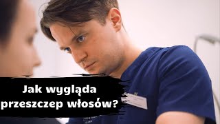 Co czeka pacjenta w dniu wykonania zabiegu przeszczepu włosów  Dr Piotr Turkowski [upl. by Ring]