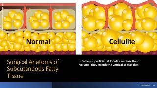 The Science of the Subcutaneous Adipose Tissue [upl. by Atnwahs]