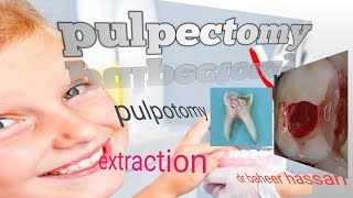 pulpotomy or pulpectomy or extraction [upl. by Hairas597]