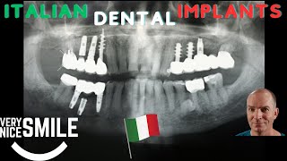 Italian Dental Implants Panoramic Xray [upl. by Idnahc]