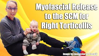 Gentle Sternocleidomastoid Myofascial Release RightSided Torticollis Treatment in Babies 042R [upl. by Ydnor]