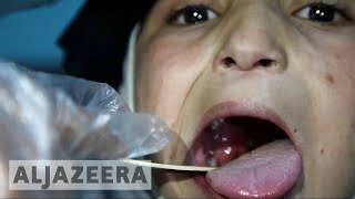 Diphtheria in Yemen More than 100 infected 14 deaths [upl. by Hinkel]