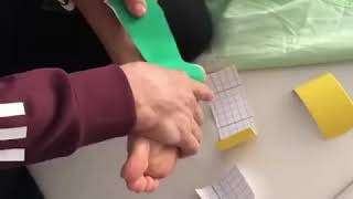 Sprain ankle taping  Eversion sprain [upl. by Saphra]