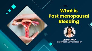 Postmenopausal Bleeding Treatment  Dr Priyanka  Vivekananda Hospital [upl. by Yddor]