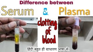 Difference between Plasma and Serum  प्लाज्मा औऱ सीरम में अन्तर DOCTORLab [upl. by Nairod]