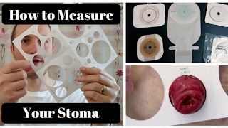 How to Measure Your Stoma OSTOMY TIPS [upl. by Thury]