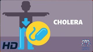 CHOLERA Everything You Need To Know [upl. by Kynan402]