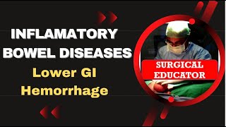 INFLAMMATORY BOWEL DISEASE  How To DIAGNOSE amp TREAT Lower GI Hemorrhage [upl. by Chapel]