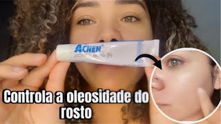 ACNEN PERÓXIDO DE BENZOÍLA  PELE OLEOSA  ESPINHA E ACNE [upl. by Ennaimaj]