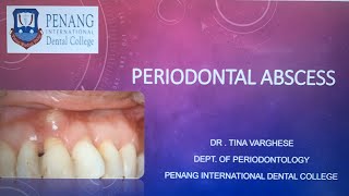 Periodontal Abscess [upl. by Tiphany]