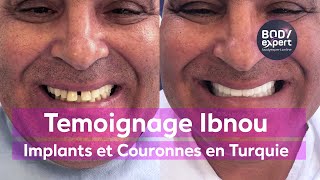 SOINS DENTAIRES  🦷 Témoignage implants et couronnes dentaires  All in 6  BODYEXPERT [upl. by Aohsoj508]