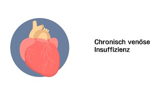 Chronisch venöse Insuffizienz CVI  Erkrankungen der Gefäße und des Kreislauf [upl. by Kenelm]