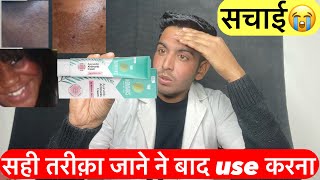 No marks cream use karne ka tarika  bajaj nomarks cream  No marks cream review  Bajaj no marks [upl. by Artenal]