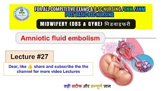 Amniotic fluid embolism  Lecture 27  OBS and gyne class  for all nursing examination [upl. by Eylloh]