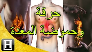 علاج حرقة المعدة والحموضة طبيعيا وبأفضل وأسهل الوصفات [upl. by Yrem]