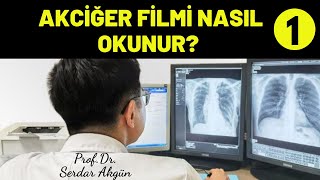 Akciğer Filmi Nasıl Okunur IBölüm VadeMecum Tıp Dersleri Serdar Akgün [upl. by Aneele985]