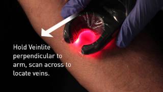 Veinlite LED Vein Finder Demo [upl. by Yeliac]