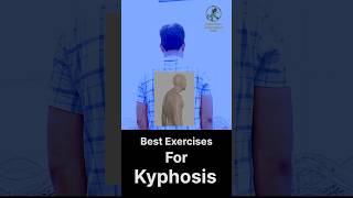 Struggling with Kyphosis Try These Exercises to Improve Posture [upl. by Nyroc38]