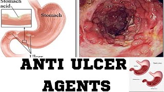 Anti Ulcer AgentsPPIH2 RECEPTOR ANTAGONISAMHARIC TUTORIAL [upl. by Zetniuq960]