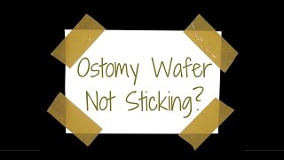 Ostomy wafer not sticking Here are a few tips [upl. by Pucida889]