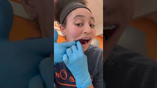 Elastics for braces Wear them it does really help‼️‼️braces bracestips dentalassistant [upl. by Inal]