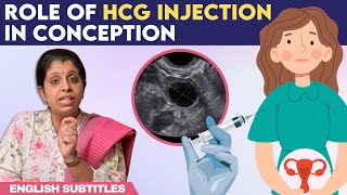 Role Of hCG Injection In Conception  hCG ஊசி செலுத்திய பிறகு கரு முட்டை எப்போது வெளிவரும் [upl. by Giorgi300]