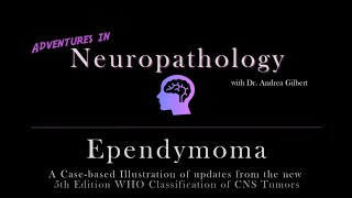 Ependymoma Update from the 5th Edition WHO Classification of CNS Tumors [upl. by Rex]