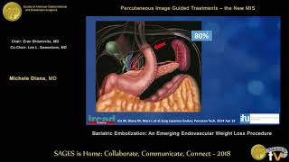 Bariatric embolization an emerging endovascular weight loss procedure [upl. by Moishe705]